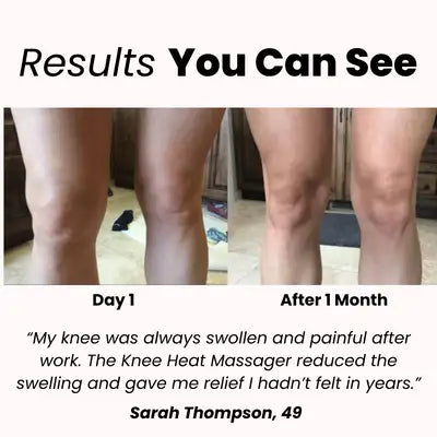 Akıllı Isıtmalı Diz Masaj Cihazı – Kızılötesi Terapi, Titreşim ve Ağrı Giderici Masaj